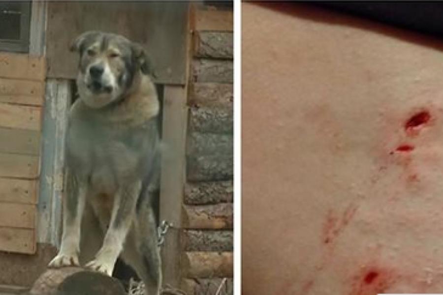 «За детей страшно»: собаки латвийского священника периодически нападают на людей