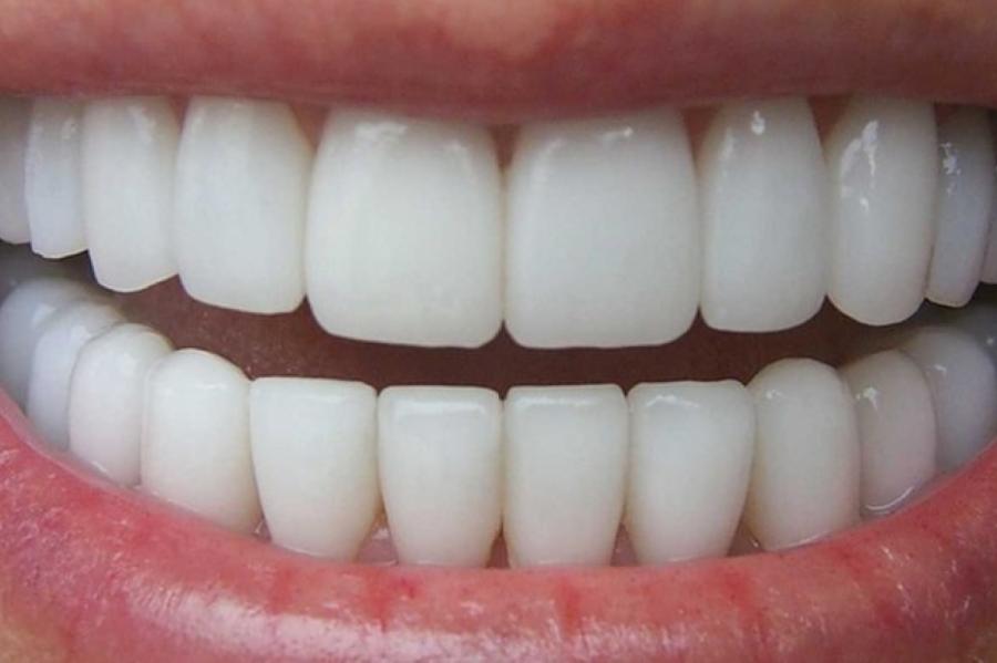 Британские ученые выяснили, как заставить зубы вырасти заново