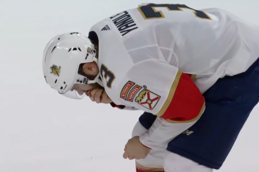 Шайба попала в лицо игроку НХЛ и лишила его девяти зубов (+ВИДЕО)