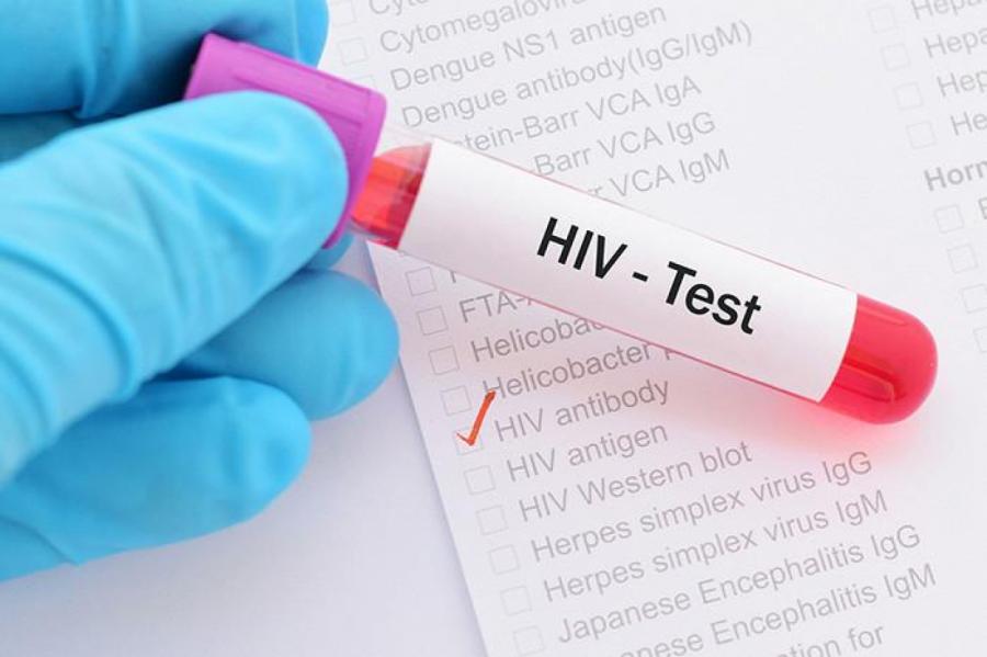 Латвия по числу вновь диагностированных случаев ВИЧ впереди Европы всей