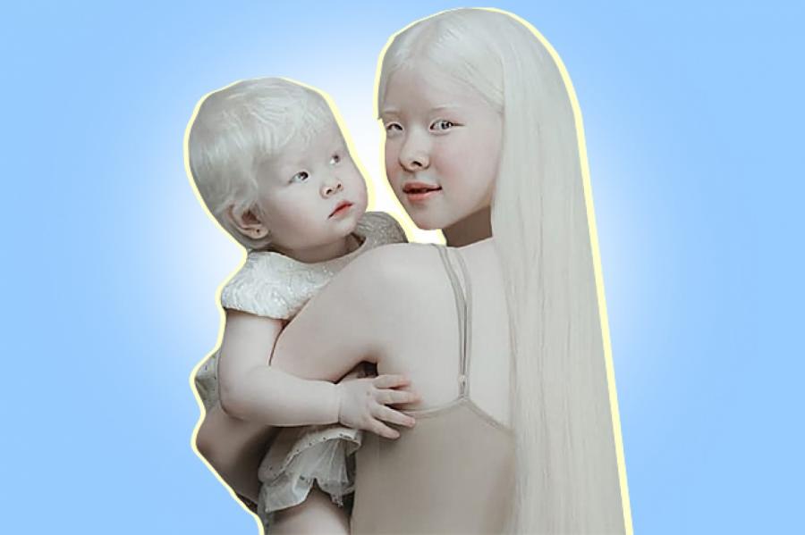 "Ангелы во плоти": как сестры-альбиносы из Казахстана стали звездами инстаграма