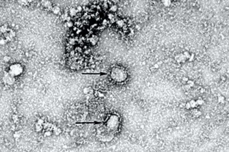 Китай опубликовал снимок нового коронавируса