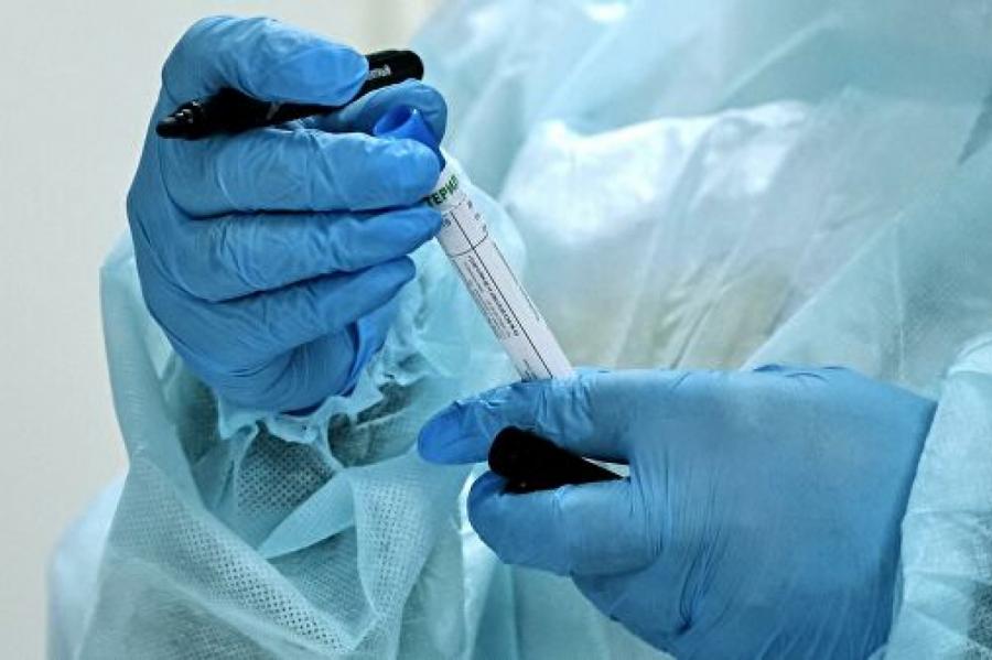 Названы болезни, повышающие риск умереть при коронавирусе