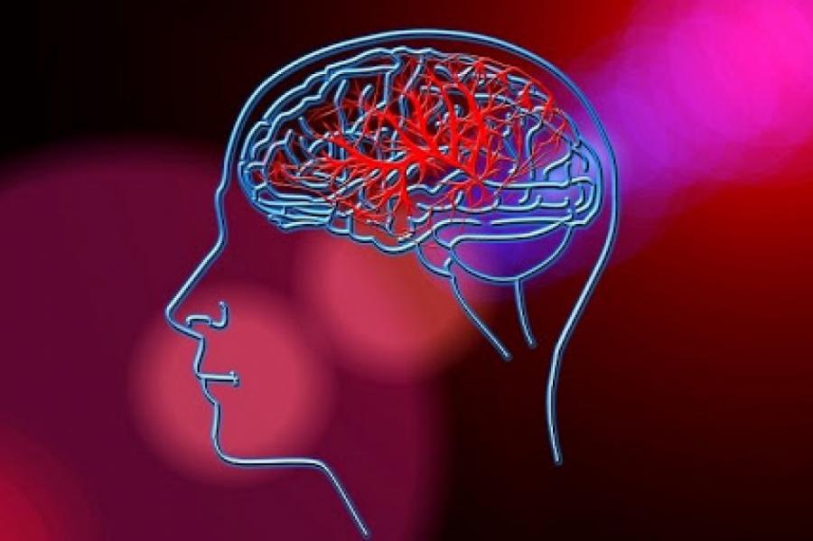 Неврологи научились восстанавливать мозг после инсульта