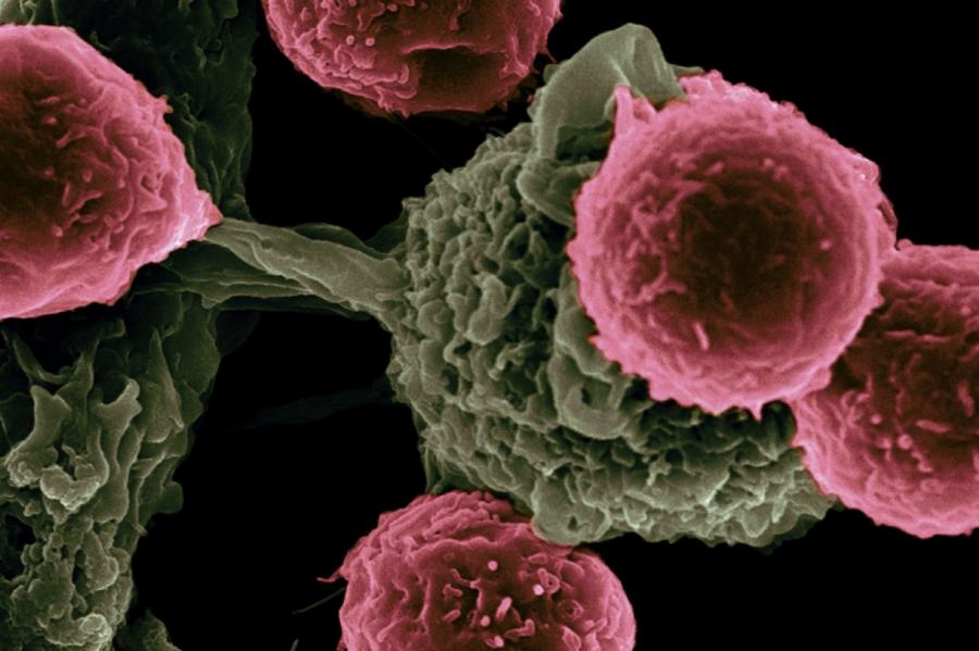 #пронауку: ученые выяснили, почему рак часто плохо поддается лечению
