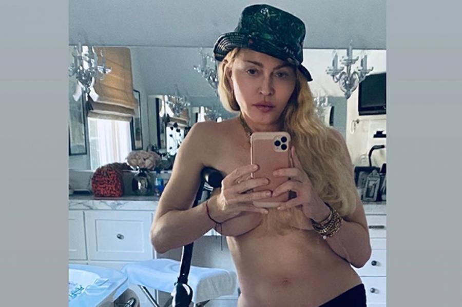 С костылем и без одежды: Мадонна поделилась новым селфи