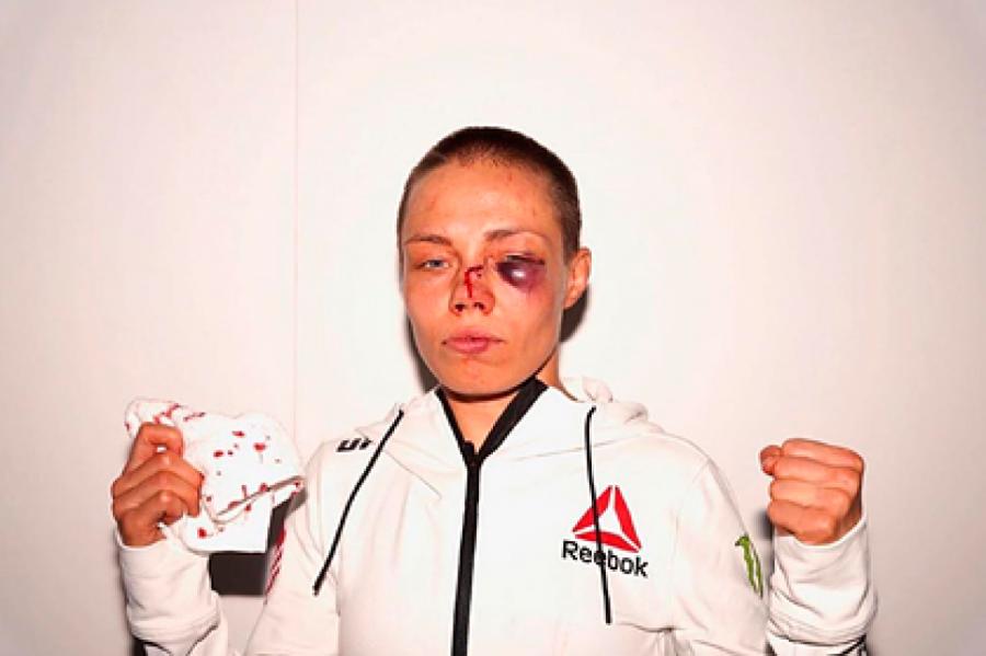 Гематома на лице девушки-бойца после турнира UFC испугала фанатов
