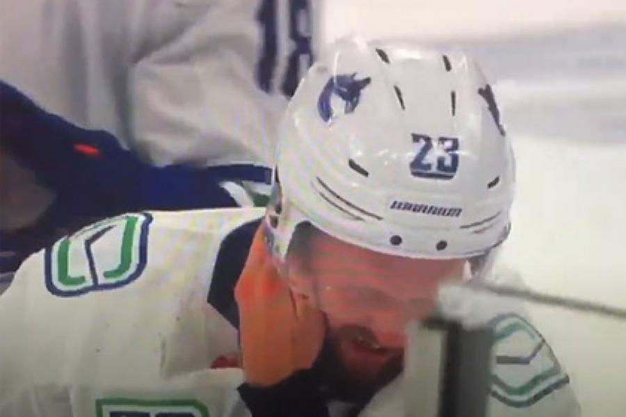 Игрок НХЛ получил удар в голову коньком в матче Кубка Стэнли (ВИДЕО)