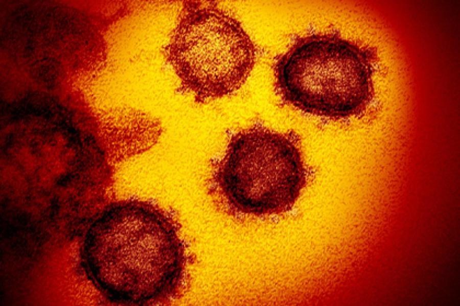 Найден новый способ убить коронавирус