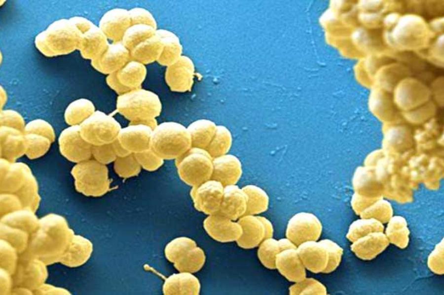 Исследование: каннабидиол убивает бактерии, вызывающие гонорею и менингит
