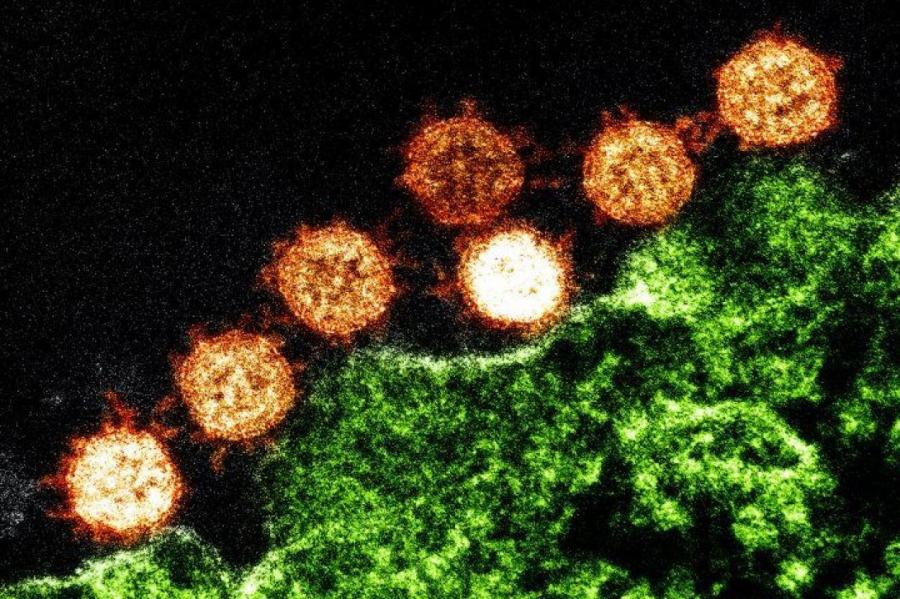 Эксперт рассказал, что снижает риск заражения коронавирусом