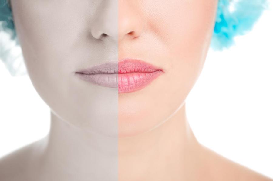 Результат поражает: до и после увеличения губ