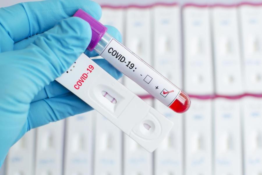 Государство больше не оплачивает тесты на Covid-19 без направления врача