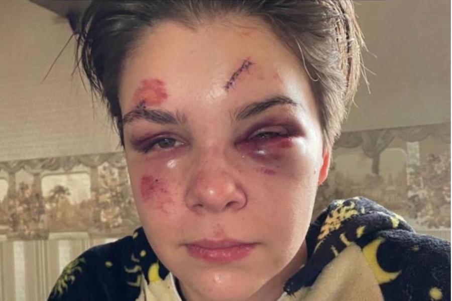 Полиция начала дело после нападения на девушку в Верманском саду