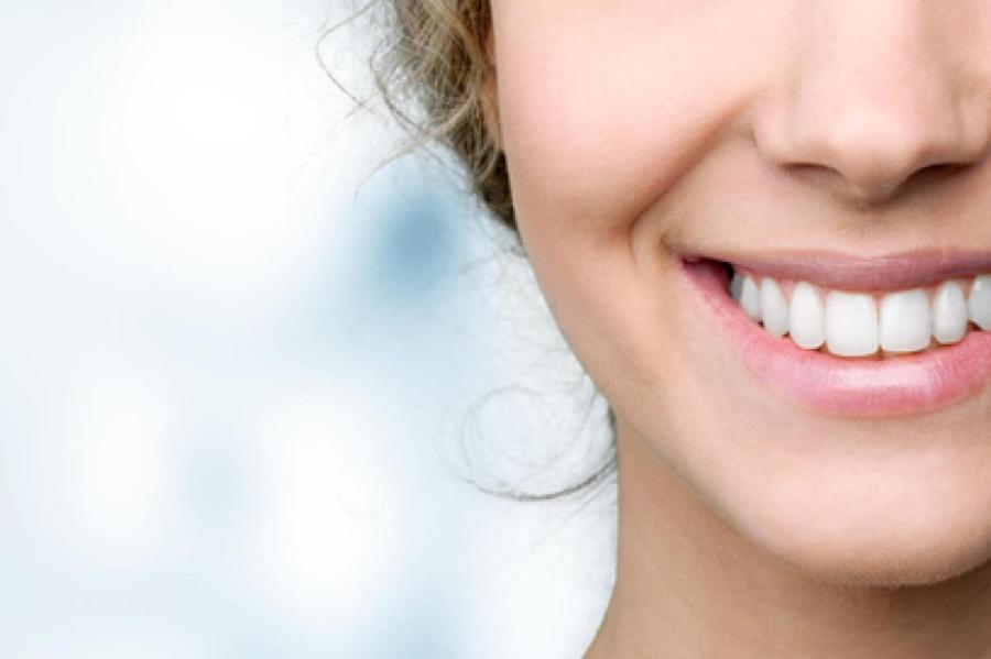 5 лучших способов отбеливания зубов в домашних условиях