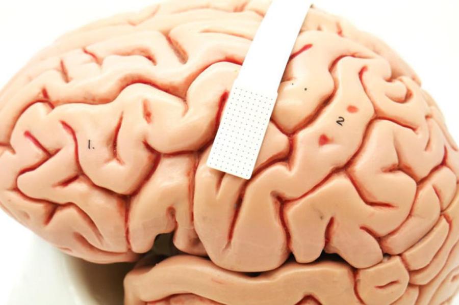 Телепатия в жизни: испытан мозговой имплантат для общения только мыслями