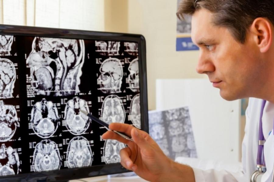 Шведские ученые: «У людей с постковидным синдромом изменилось строение мозга»
