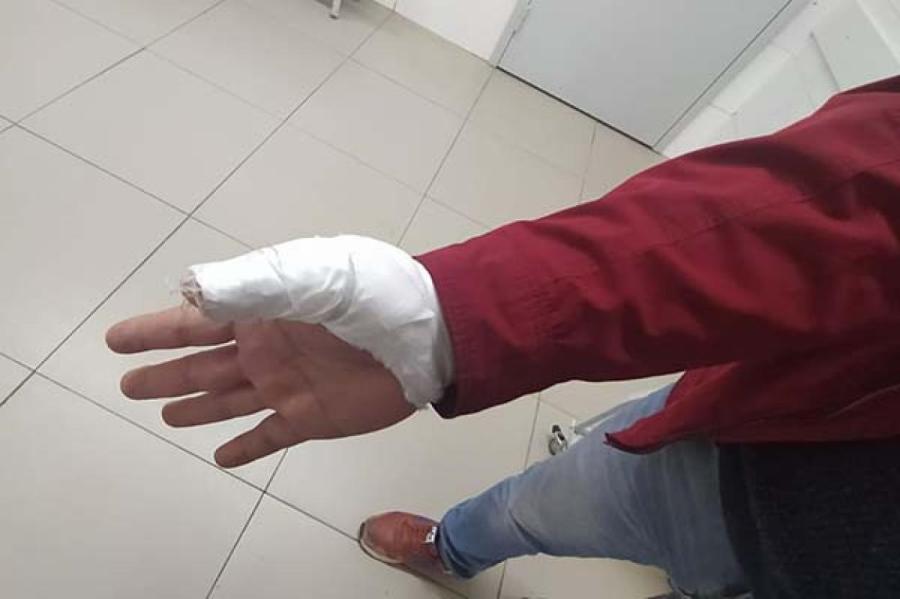 В Даугавпилсе сосед соседу сломал палец. И еще плевался
