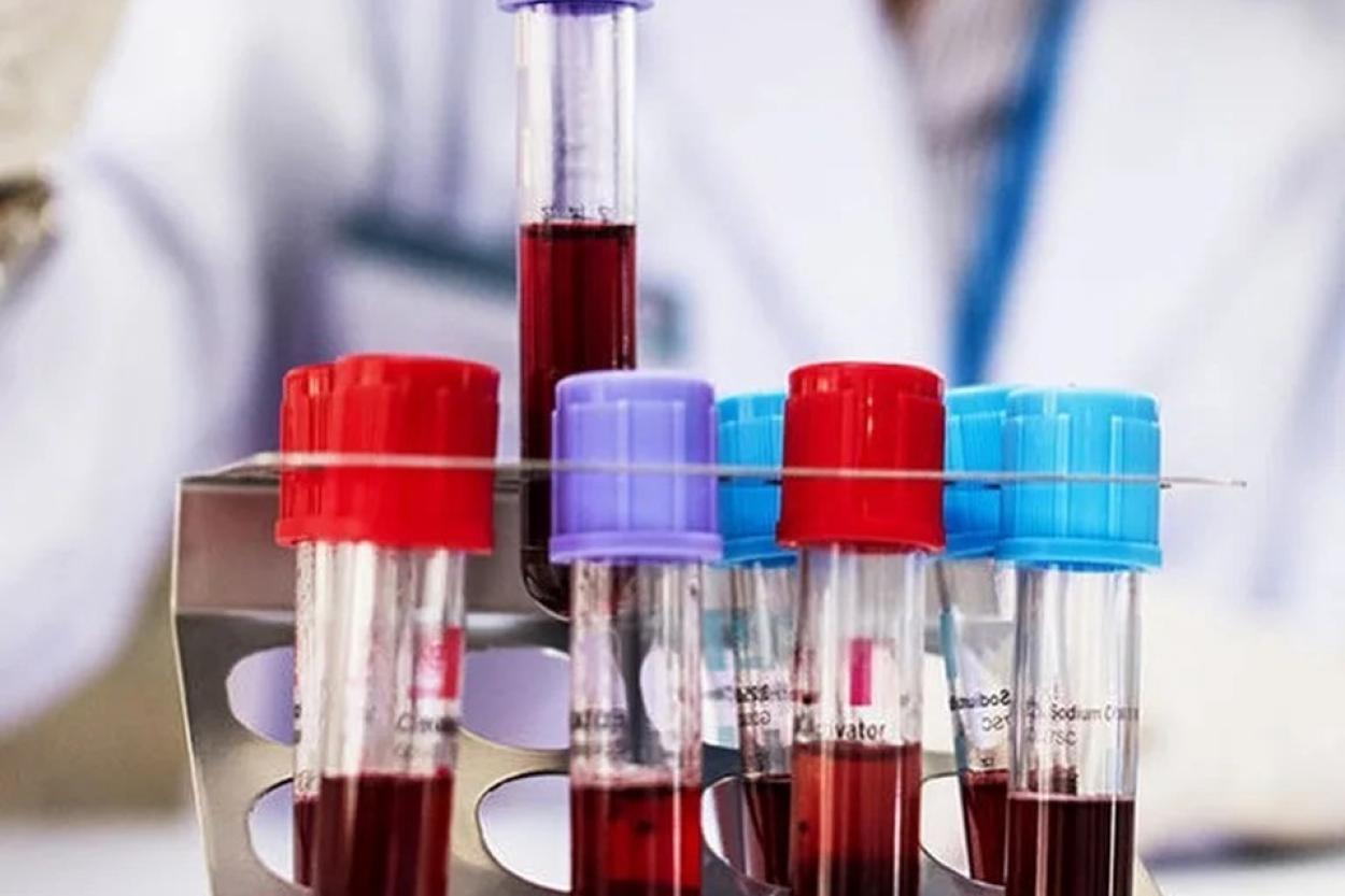 Как расшифровать анализ крови: объясняет врач-диагност