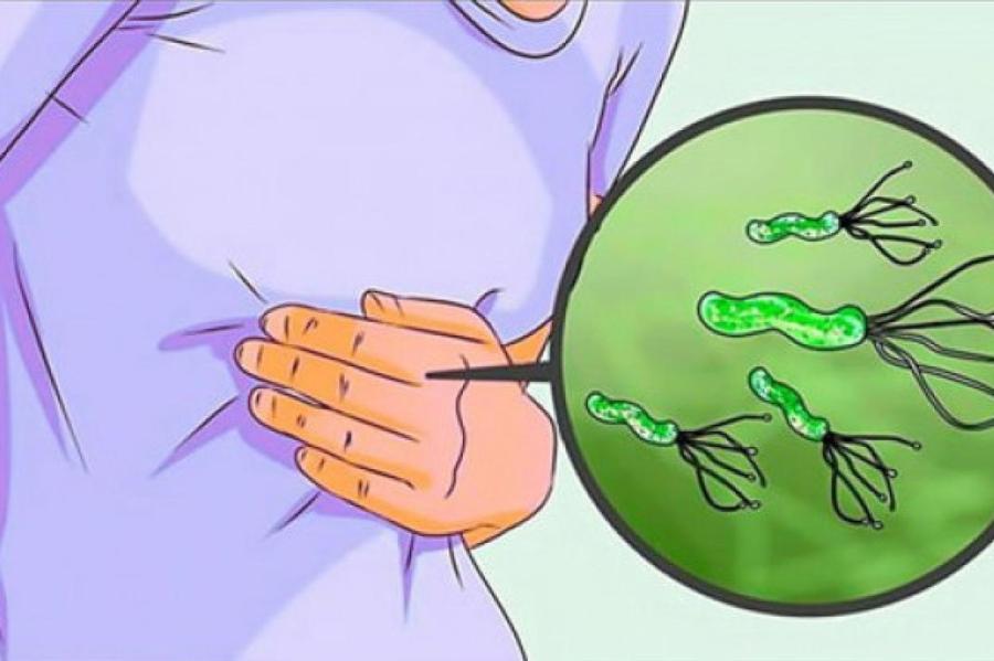 Как обнаружить в желудке бактерию, которая вызывает гастрит и язву