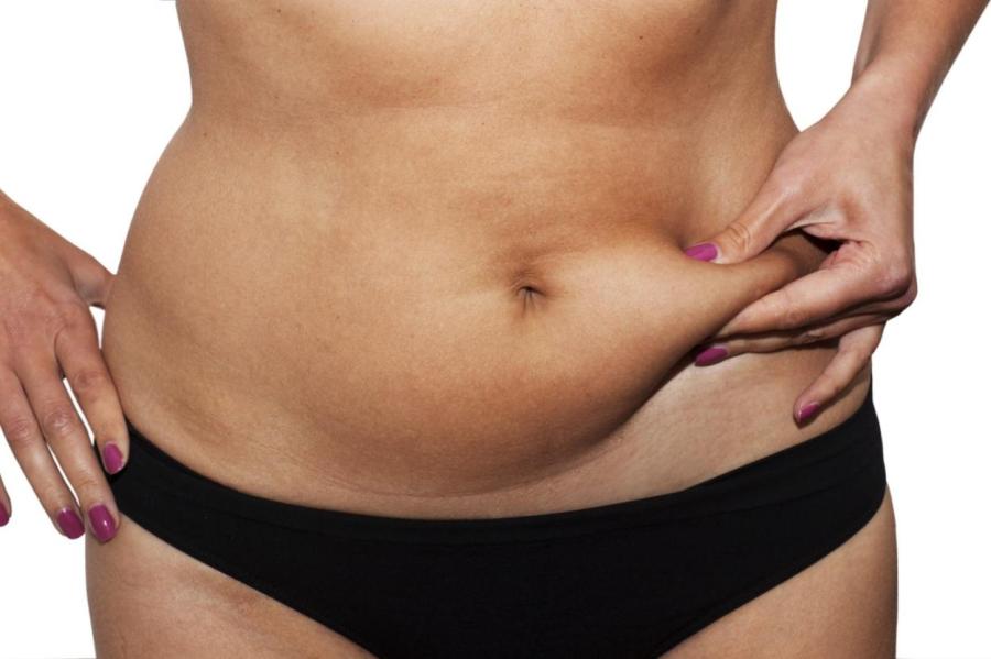 Эндокринолог подсказала верный способ убрать жир с живота
