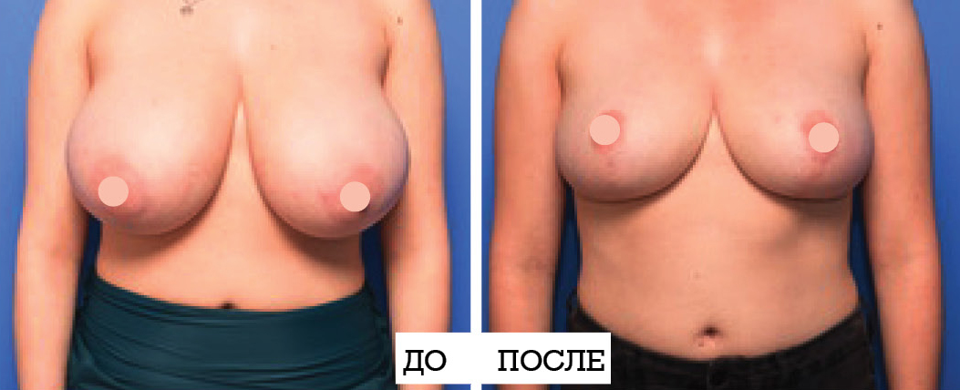Gilis3.jpg