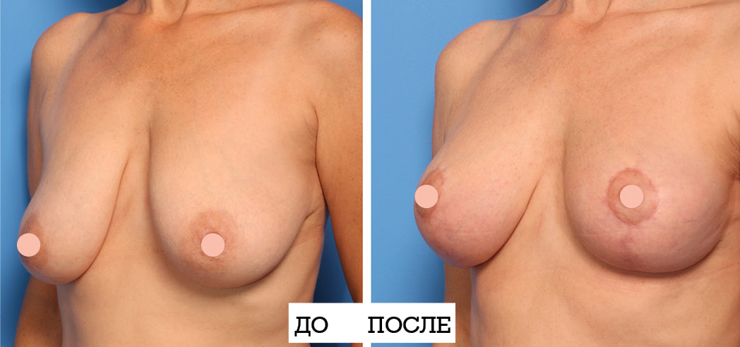 Gilis4.jpg