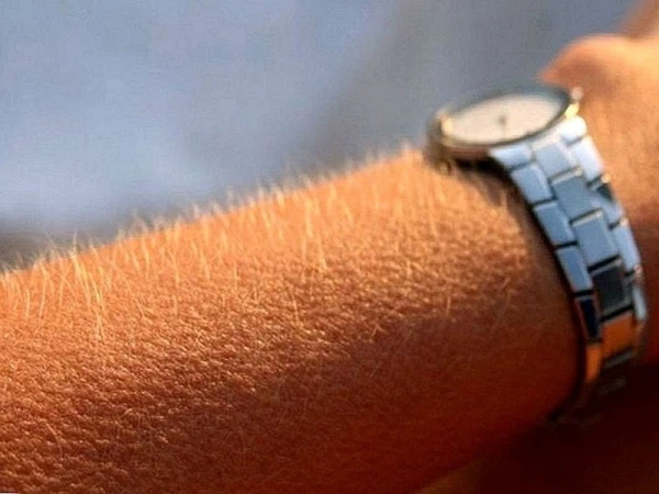 Изображение к статье: О чем свидетельствуют мурашки на коже