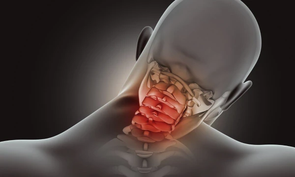 Шейный остеохондроз: причины, симптомы и лечение