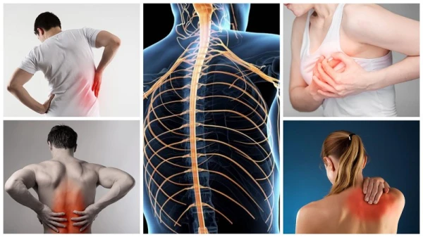 Изображение к статье: Что такое невралгия и как ее лечить