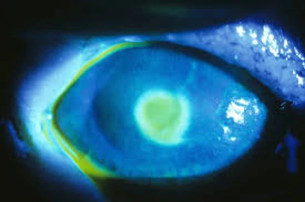 Изображение к статье: Илон Маск захотел вживить в мозг возвращающий зрение чип