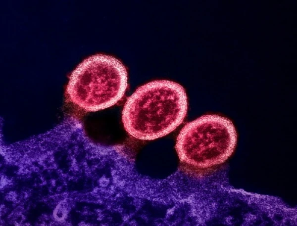 Изображение к статье: Датские ученые выяснили, почему пещерные люди не болели ВИЧ