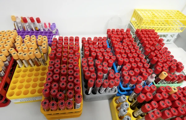 Изображение к статье: Хватит уже направлять на анализы  - деньги закончились!