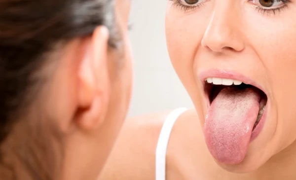 Изображение к статье: Горечь во рту и налет на языке: сигналы организма, которые нельзя игнорировать