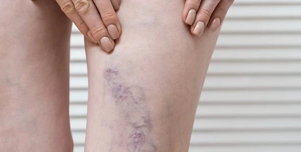 Изображение к статье: Иллюстративное фото.