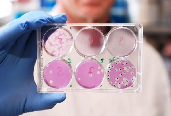 Изображение к статье: Впервые найден способ предотвратить опасный вирус