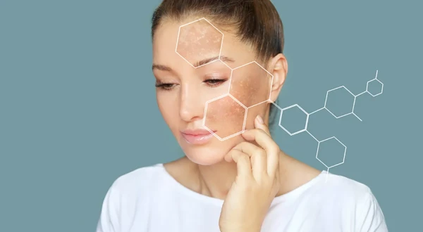 Изображение к статье: Что есть, чтобы убрать пигментные пятна — нутрициолог дала рекомендации