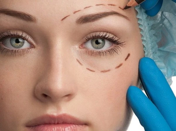 Изображение к статье: Блефаропластика: мифы и правда