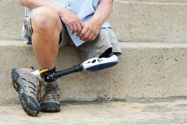 Изображение к статье: Благодаря войне Россия стала лидером в сфере протезирования - DW