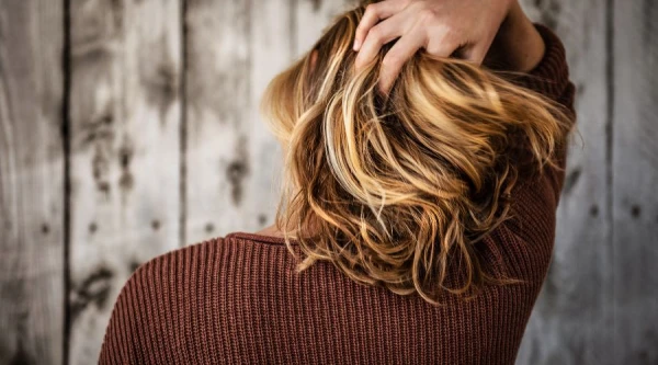 Изображение к статье: Назван неожиданный фактор облысения