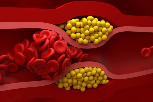 Изображение к статье: 5 мифов о холестерине и почему их должен знать каждый