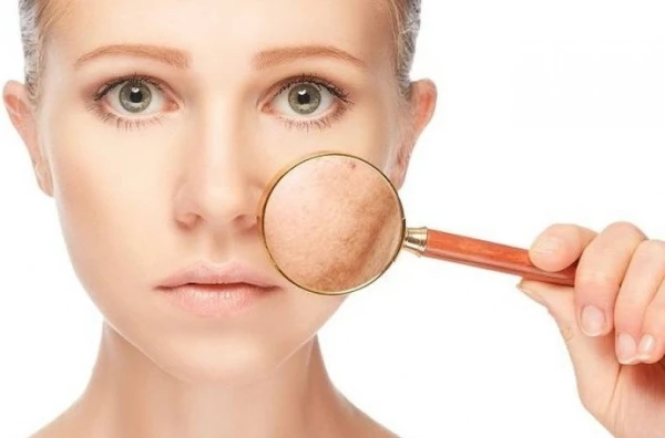 Изображение к статье: Твоя кожа «запоминает» всё: 6 привычек, из-за которых появляются пигментные пятна