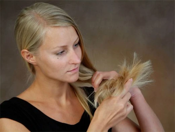 Изображение к статье: Названы два провоцирующих облысение напитка