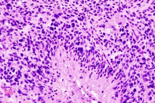 Изображение к статье: Фото: KGH / Wikimedia