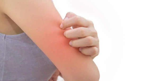 Изображение к статье: Почему зимой кожа начинает чесаться: учёные нашли неожиданную причину