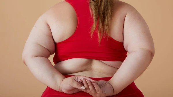 Изображение к статье: Раскрыта не связанная с едой причина ожирения