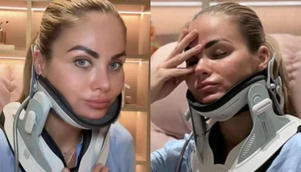 Изображение к статье: Королева красоты Диана Кубасова страдает от болей в шее и мигрени, врач посоветовал ботокс