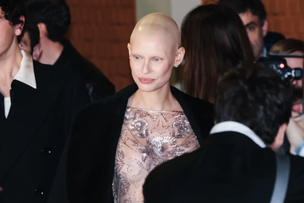 Изображение к статье: Бьянке пришлось пройти через химиотерапию.