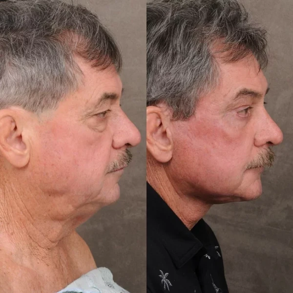 Изображение к статье: Осталось только седину извести, и как новенький.