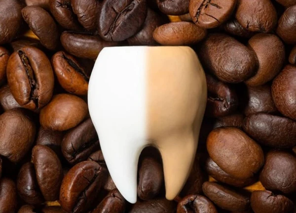 Изображение к статье: Робуста или арабика? Какой сорт кофе меньше красит зубы